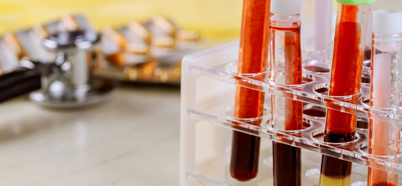 10 Essential General Health Tips